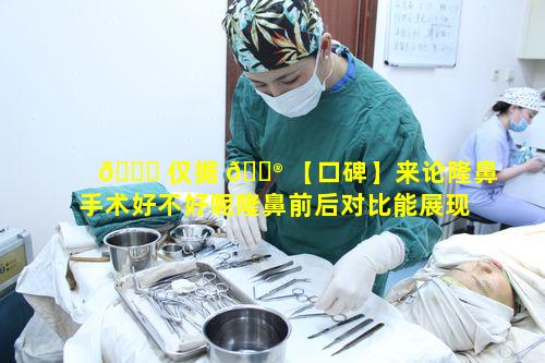 🐋 仅据 💮 【口碑】来论隆鼻手术好不好呢隆鼻前后对比能展现真实情况吗